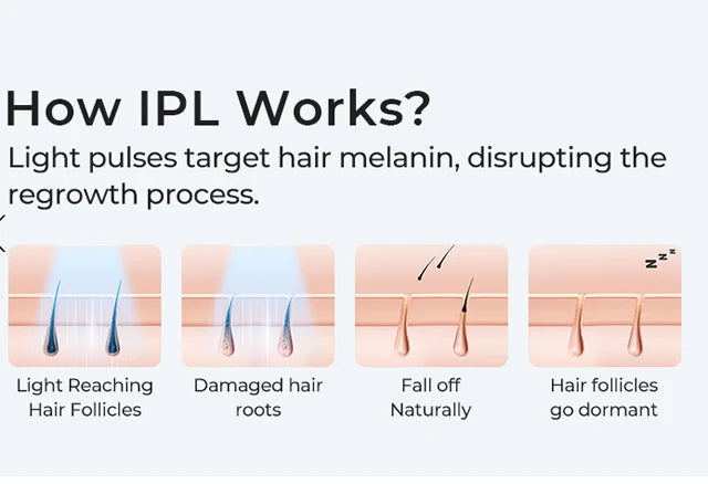 The Revura Silk™: Elite IPL System